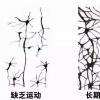 运动能增加大脑中血清素和多巴胺的水平吗？|研究