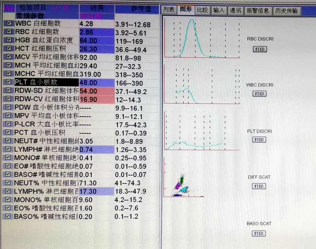 大型血小板比率偏高48_大型血小板比率低的原因_大血小板比率低