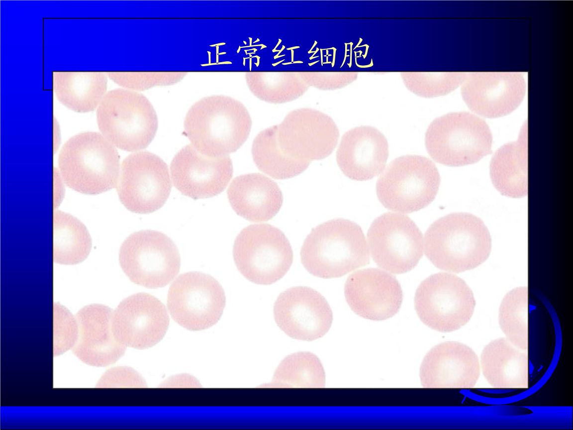 plt体积分布宽度偏低_红细胞体积分布宽度偏低_红细胞体积分布宽度偏低6